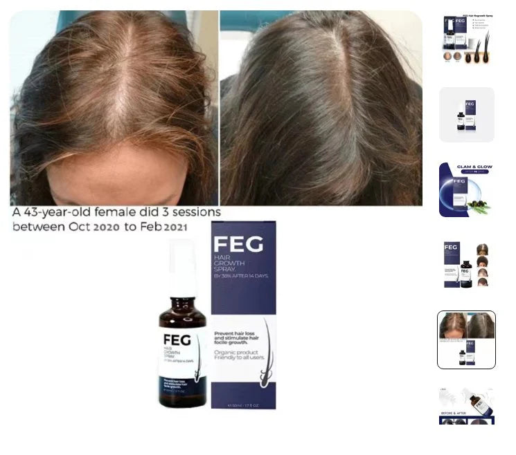 FEG plus Hair Growth Spray - 100% Original For Men & Women