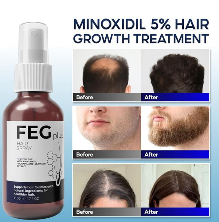 FEG plus Hair Growth Spray - 100% Original For Men & Women